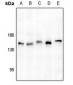 Anti-ULK1 Antibody
